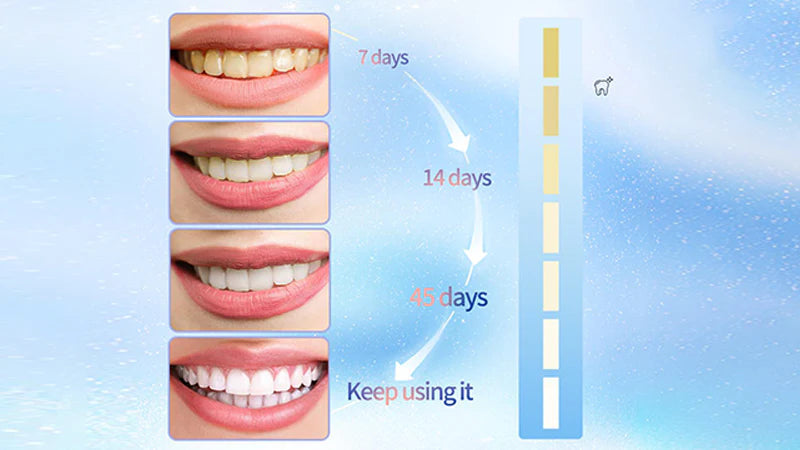 GleamGuard™️ Whitening Toothpaste